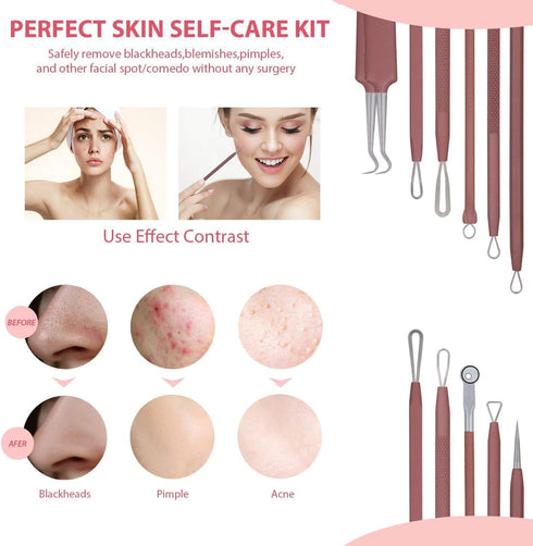 JPNK Blackhead Remover Tool Kit, 6 Pcs Comedones Extractor for Blemish Removal with Leather Bag (Pink)