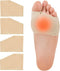 ViveSole Metatarsal Foot Pad (4 Pcs) - Cushions for Metatarsalgia Pain Relief, Forefoot Sleeve with Gel Insert