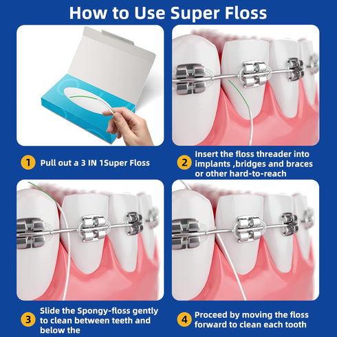 Dental Floss for Braces, Floss Threaders for Bridges & Implants, 80 Pre-Cut Strands, 80PCS (Pack of 2)