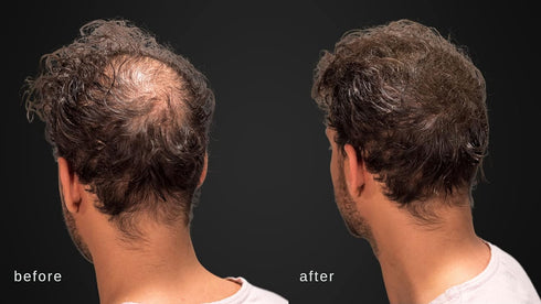Volumizing Hair Fibers with Real Keratin for Thinning Hair - 60 Days+ Supply - Dermatologist Tested (Medium Brown)