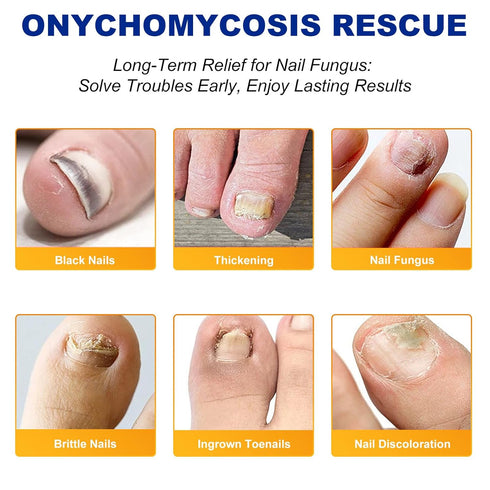 Weluno 32 8-Hour Nail Patches PCS, Toenail Treatment Extra Strength, Overnight Nail Fast Acting Repair Effortless