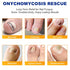 Weluno 32 8-Hour Nail Patches PCS, Toenail Treatment Extra Strength, Overnight Nail Fast Acting Repair Effortless