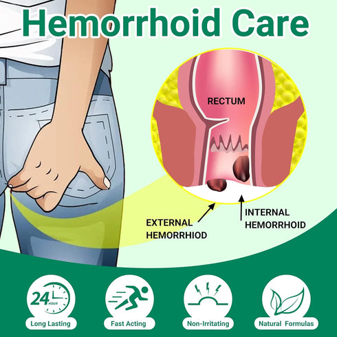 Hemorrhoid Treatment Ointment, Maximum Strength for Pain, Itching, Burning, Swelling, Long-Lasting Hemorrhoid Cream