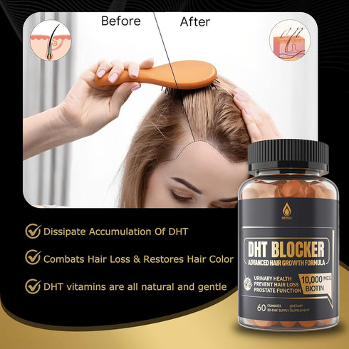 Envy Deal DHT Blocker Gummies Hair Growth Supplement, 10000 mcg Biotin & Saw Palmetto, 2Pc/120ct for Men & Women