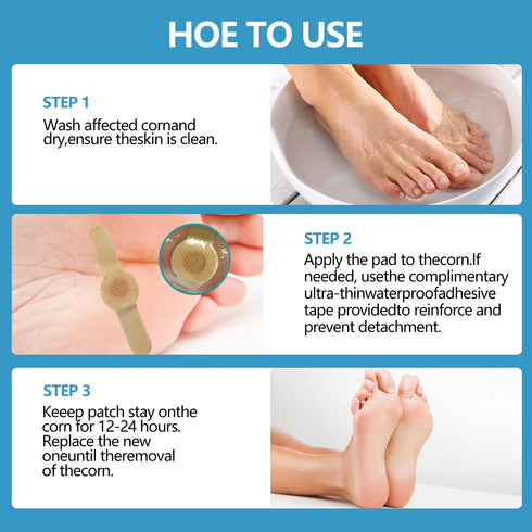 RHAICARE Remover(24 Count),Corn 40% Corn removers for Toes feet Bottom of Foot Corn Pads Remover for Toes feet