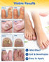 Nail Repair Patches Extra Strength, 28 Count for Damaged Nails, Nighttime Renewal Patches