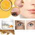 Lanthome Turmeric Face Cream - 50g Anti-Aging Moisturizer for Dark Spots and Even Skin Tone