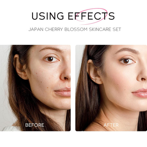 Sakura Face Care Set - 17Pcs Moisturizing Skin Care Routine with Cream, Cleanser, Serum, and Masks