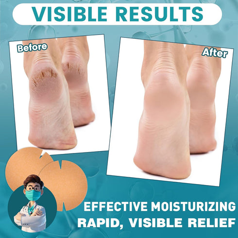TEAWOO 30PCS (80mm 80mm) Patented Cracked Heel Treatment Patches, Cracked Heel Repair Bandage x