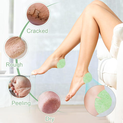 TEAWOO 30PCS Patented Aloe Vera Cracked Heel Treatment Patches, New Upgraded Cracked Heel Repair Bandage