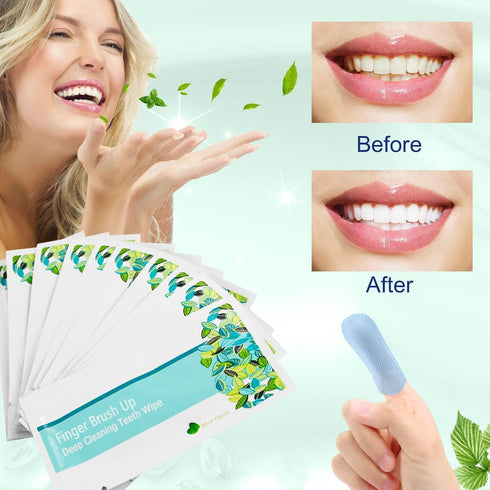 EZGO 100pcs Deep Cleaning Teeth Wipes, Finger Brush, Latex Free Mint Flavor
