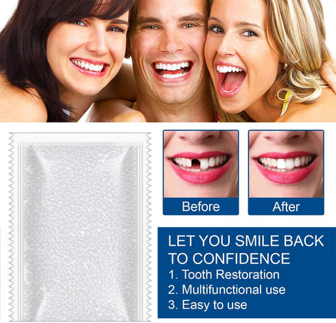 Tooth Repair Kit - 30ml / 1.05 oz Teeth Replacement with Moldable Heat Fit Beads for Temporary Restoration and