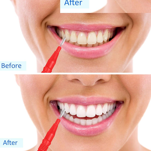 BBTO 100 Pcs Braces Dental Brush Flosser for Cleaner Interdental Brush Toothpick Dental Cleaning Tool