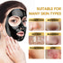 Blackhead Remover Mask Kit, Charcoal Peel Off Facial Mask with Brush and Pimple Extractors, Deep Cleansing for Face Nose Blackhead Pores Acne, For All Skin Types (3.5 Fl.oz)