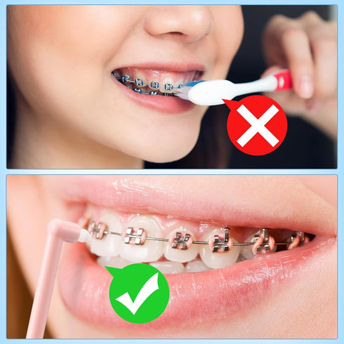 48 Pcs End Tuft Toothbrush Individually Wrapped, Small Head Reusable Orthodontic Toothbrush for Detail Cleaning