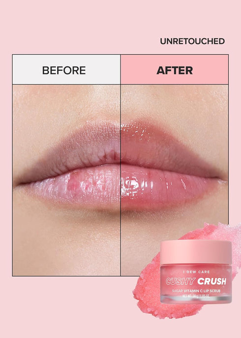 I DEW CARE Lip Scrub - Cushy Crush | Sugar Vitamin C Lip Care Exfoliator for Dark, Dry and Chapped Lips, Vegan, 1.05 oz