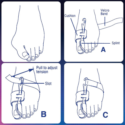 PediFix Nighttime Bunion Regulator, Large Left