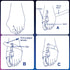 PediFix Nighttime Bunion Regulator, Large Left
