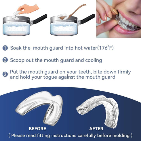 Kids Mouth Guard for Teeth Grinding, Pack of 8, Comfortable Custom Dental Guard, Moldable Night Guards for Clenching