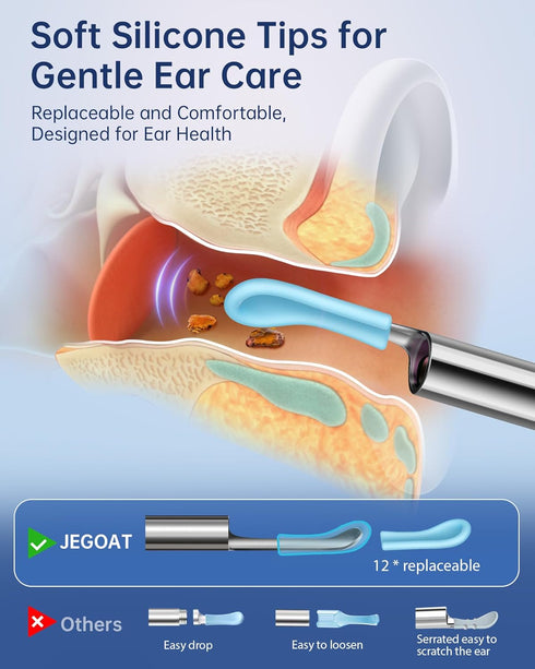 Ear Wax Removal Tool Camera, Ear Cleaner with 1296P HD Scope, 6 LED Lights and 12 Ear Picks
