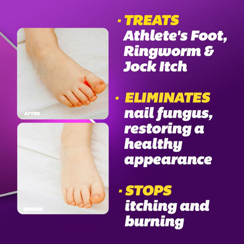 Set Silka Max Strength Antifungal Liquid & Cream - Powerful Relief for Toenail Fungus, Athlete's Foot, and Ringworm