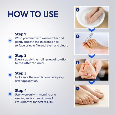 Lakeim 25% 3 5 Toenail Fungus Treatment Extra Strength: Undecylenic Acid & Tea Tree Oil - Repairs Yellow Thick Brittle