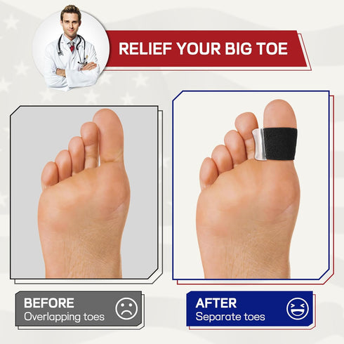 TPVEEN Orthopedic Gel Toe Separators for Overlapping Toes,Big Toe Spacers for Hallux Valgus Corrector with Shock