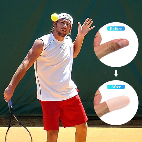 ANCIRS 10pcs Gel Finger Support Protector Caps, Silicone Fingertips for Cracking, Eczema, Trigger Finger Relief