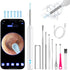 Ear Wax Removal Tool Camera, Ear Cleaner with Camera, Ear Cleaning Kit 1296P HD Ear Scope with 6 LED Lights and 6 Ear