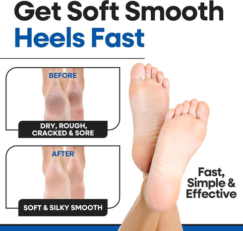 Moisturizing Socks for Women & Men | Aloe Vera Cracked Heel Treatment | Foot Callus Remover | Lotion Infused Gel Heel