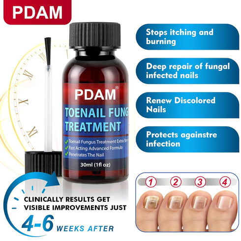 PDAM 30ml Toenail Fungus Treatment Extra Strength - Toe Nail Fungus Treatments for Thick, Nail Strengthener and Growth