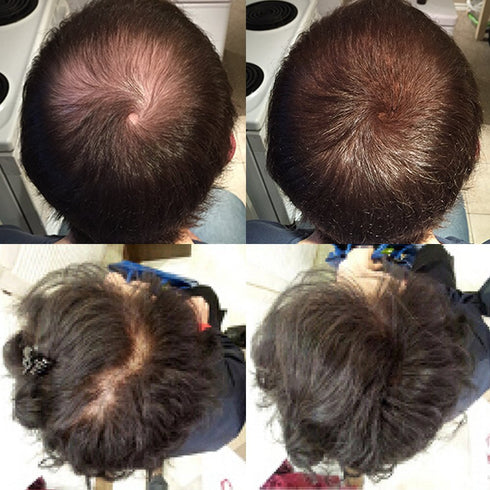 Keratin Hair Building Fibers, Natural Instant Hair Filler and Thickener for Men and Women - 25 grams
