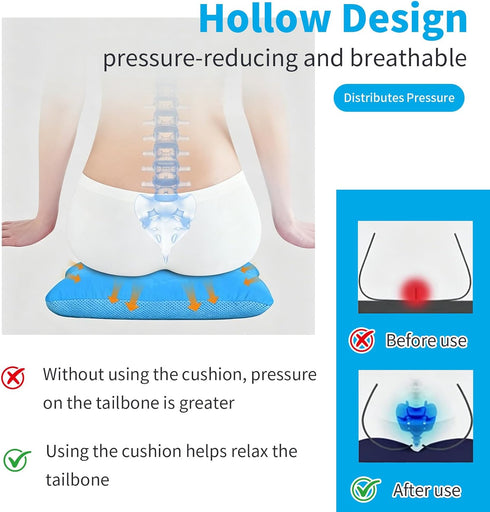 Pressure Ulcer Cushion,Bed Sore Cushions,Donut Pillow for Bed sores,Soft,Breathable and Pressure Relief Sciatica Pillow