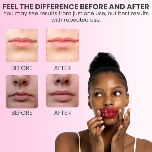 MISS SPA Lip Mask, Hydrate Boost Hydrogel Pink Mask, Soothes & Restores Lips, Moisturizing Anti-Aging Skin Care, 4 Pack