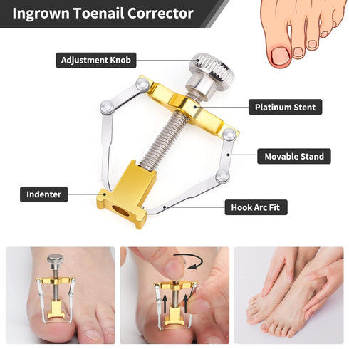 Segbeauty 10pcs Ingrown Toenail Removal Kit, Professional Manicure Pedicure Tool Set