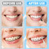 120Pcs Interdental Brushes, 360° Bendable Soft Bristles for Braces, Dental Floss Picks for Oral Teeth Cleaning