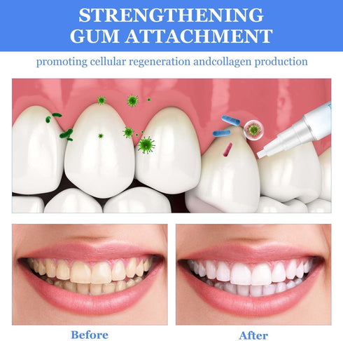 Leixu (3Pcs) Frosty Neptune Teeth Whitening, Teeth Whitening Pens Professional, Frosty Neptune Teeth Whitening Essence