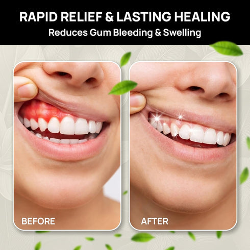 The Goodbye Company Healthy Gum Rinse Handcrafted Natural Mouthwash for Bleeding Gums, Receding Gums & Fresh Breath |