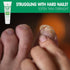 Toenail Soft Temporary Nail Softening Cream for Thick, Hard Toenails with Aloe, 1 Oz (2-Pack)