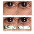 Serious Skincare C3 Vitamin C Ester Eye Beauty Treatment - 0.5 oz. with Hyaluronic Acid for Dull & Dry Under Eyes,