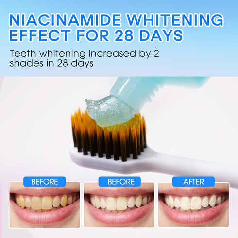 ORALUCK 3.53 Oz Hotluck Niacinamide Toothpaste | Whitening & Fluoride-Free for Healthy Gums & Fresh Breath | Removes