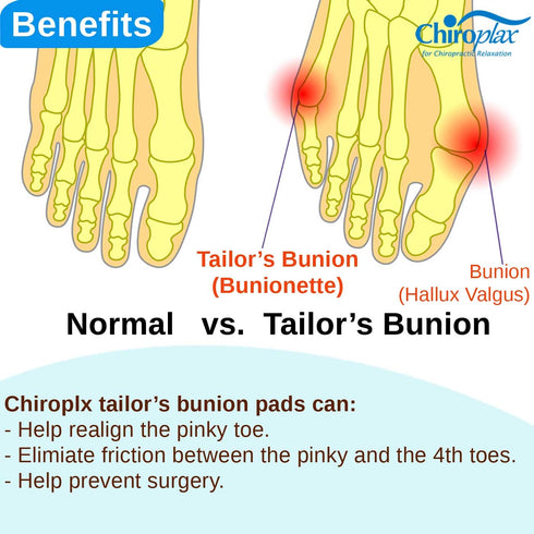 Chiroplax Bunion Corrector Pads, 4 Regular Size Silicone Cushions for Bunionette Pain Relief, Men & Women