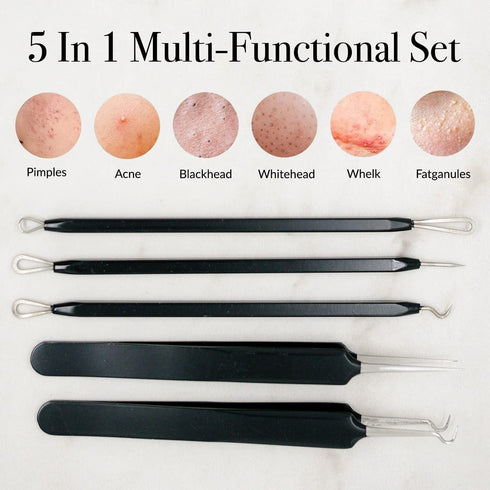Pete & Pedro Acne & Blackhead Remover Tool Set - 5 Piece Pimple Popper Kit with Mirror for Men & Women