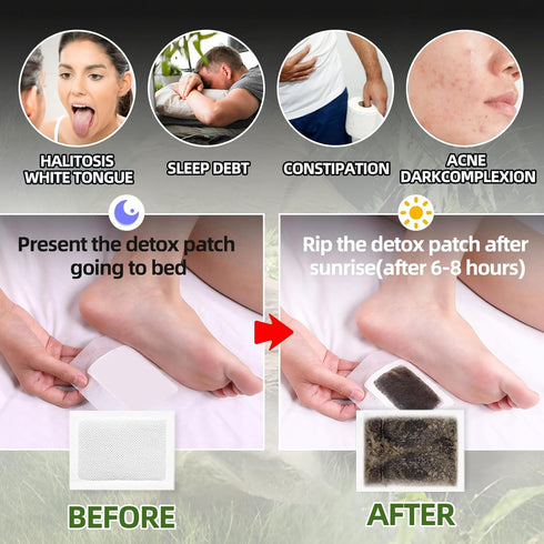 Mosconly 20 Foot Patches, Pcs Natural Ingredients Foot Care Patches with Bamboo Vinegar and Ginger Powder,Restful Sleep