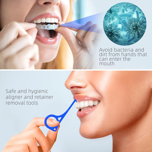 Aligner Removal Tool, 5 Invisible Braces Removal Tools for Dentures, Trays, Retainers, and Aligners (Dark Blue)