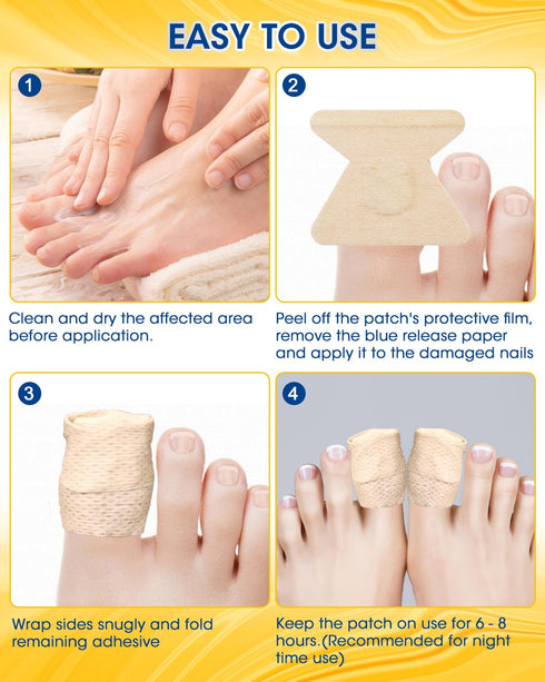Nail Repair Patches Extra Strength, 28 Count for Damaged Nails, Nighttime Renewal Patches