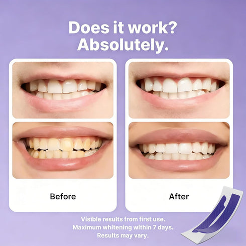 TVUGHGI Purple Teeth Whitening Strips for Surface Stain Reduction and Natural Shine Gentle Purple Teeth Whitening