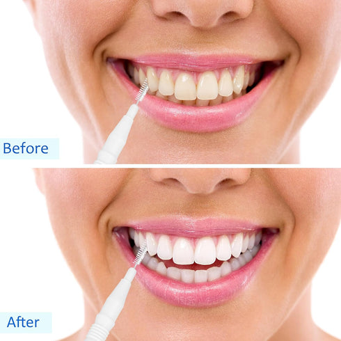BBTO 100 Pcs Braces Dental Brush Flosser, Interdental Brush Toothpick, Oral Dental Cleaning Tool, White