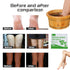 Natural Mugwort/Wormwood Herbal Foot Soak, Lymphatic Ginger Foot Bath Bag, 15g/PCS (16PCS) for Foot Care