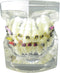 Dental Malocclusion Orthodontic Treatment Teeth Model with Metal Brackets, Colorful Ties, and Chains